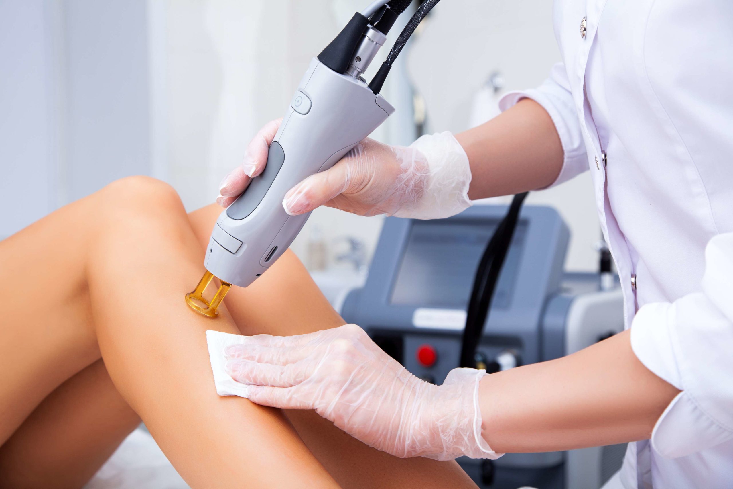 Aesthetician Giving Laser hair Removal Treatment on Patient's Legs | Melindas Med Spa & Salon in North Myrtle Beach, SC