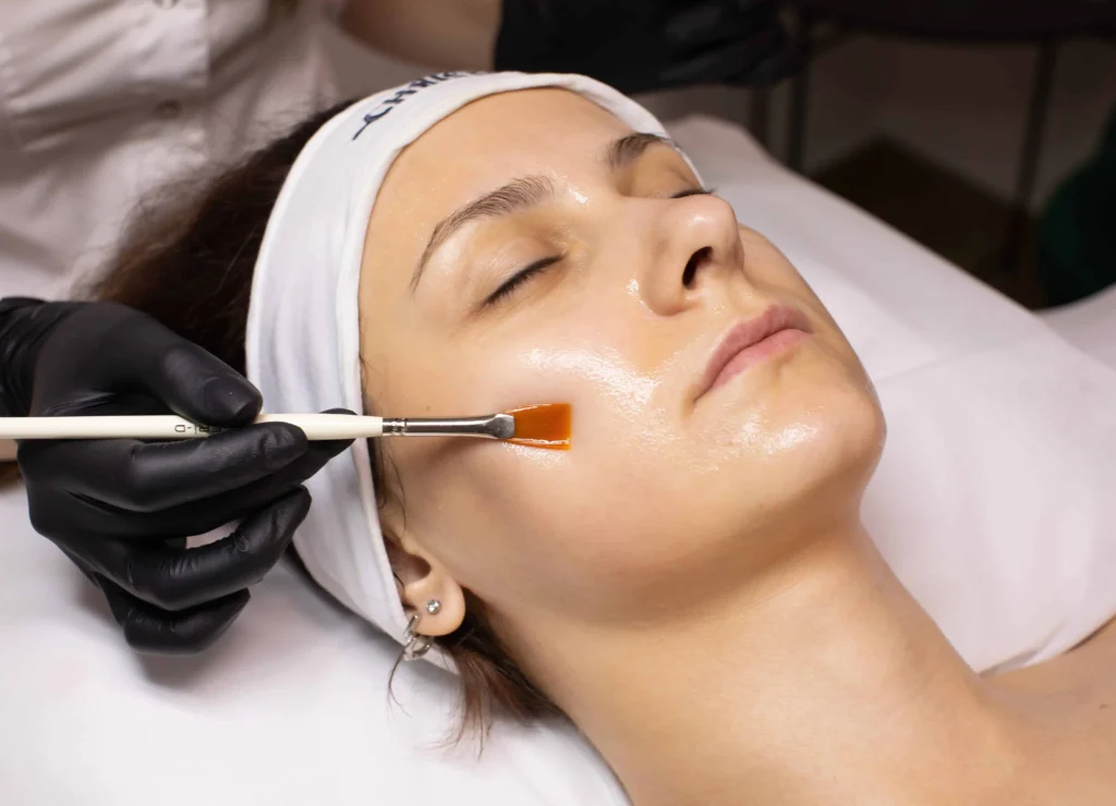 Chemical Peel By Melindas Day Spa LLC in North Myrtle Beach SC