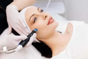 SkinPen Microneedling in North Myrtle Beach SC by Melindas Day Spa LLC