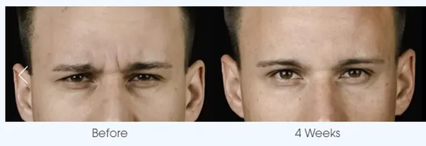 Letybo Before and After (4)