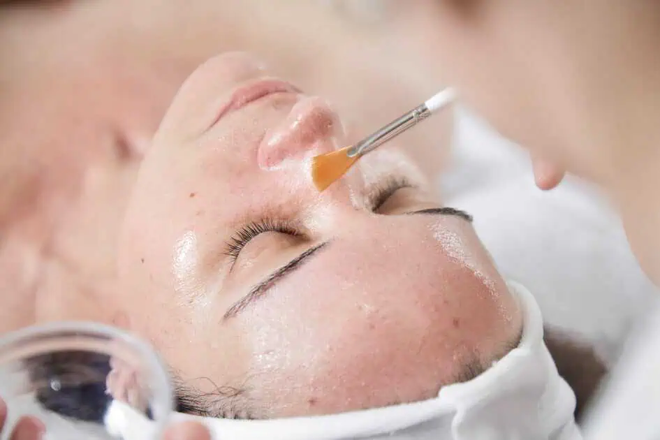 Chemical Peel in North Myrtle Beach, SC by Melindas Day Spa LLC